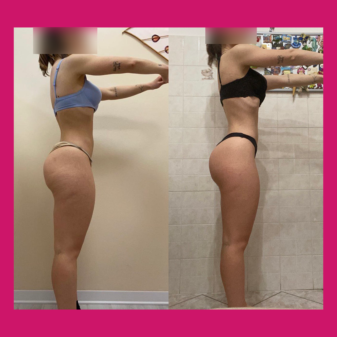 Prima e Dopo